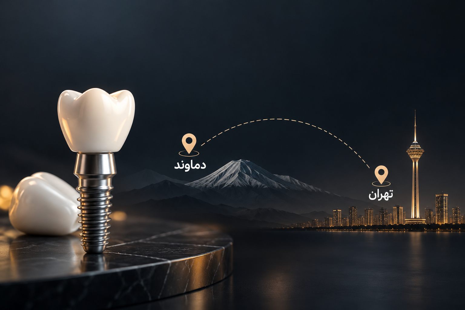 ایمپلنت دندان در دماوند؛ برای درمان در دماوند بمانیم یا به تهران مراجعه کنیم؟